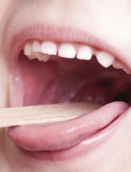 Throat Diseases