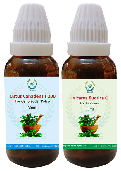 Cistus Can.200, Calcarea Flu. Q For Gallbladder Polyp