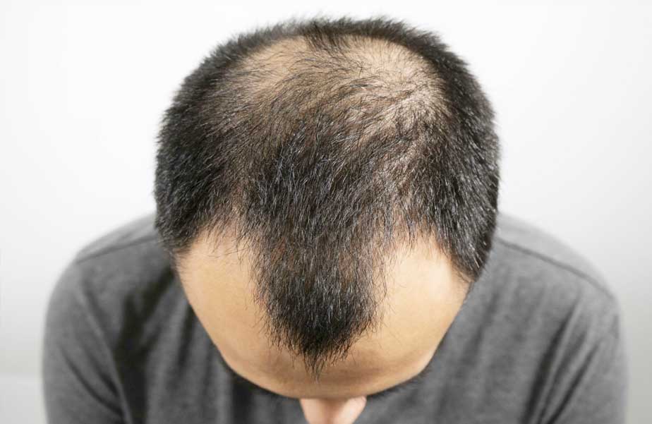 main slider 1_1670308972